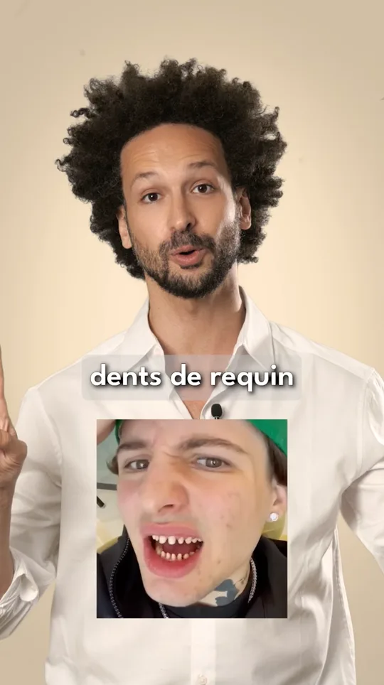 Do and Don't - Facettes et promesses Instagram