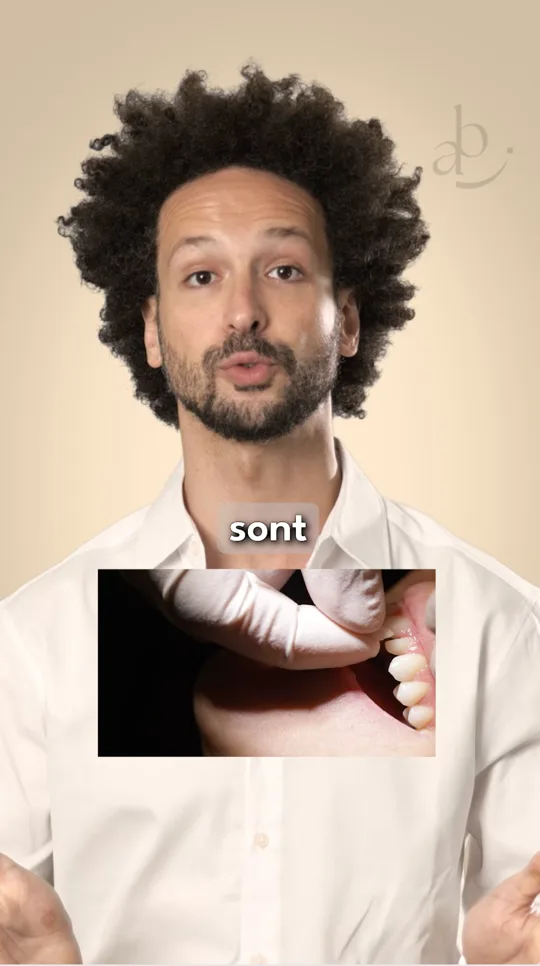 Do and Don't - Indications des facettes dentaires