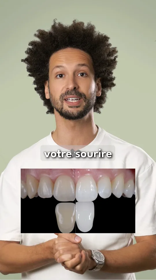 FAQ - Éclaircissement dentaire