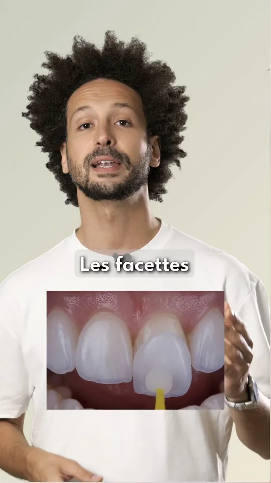 FAQ - Facettes dentaires