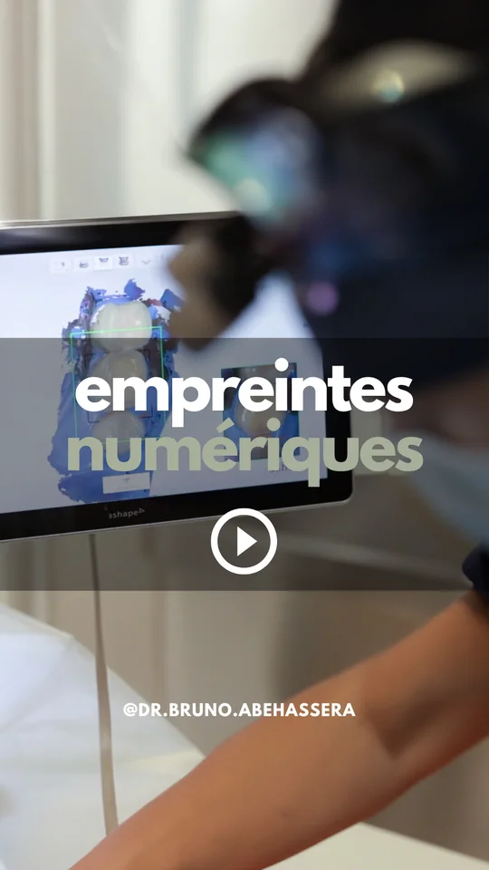 Empreinte dentaire numérique : le scanner intra-oral