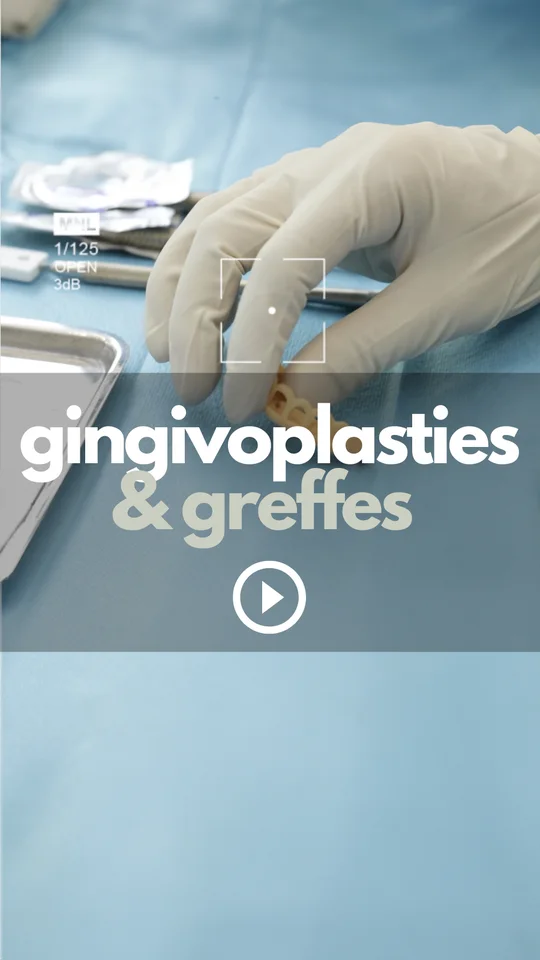 Gingivoplastie ou greffe de gencive : quelle différence ?