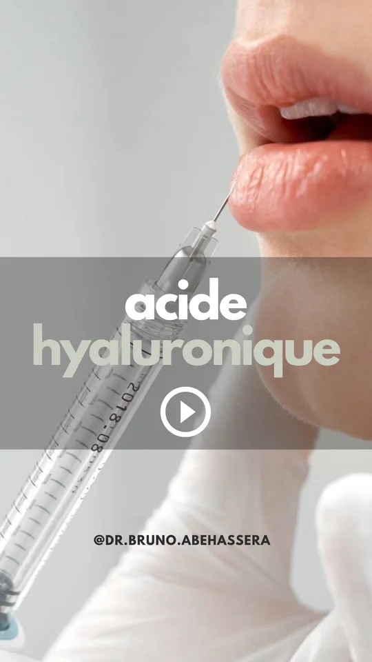 Injections d’acide hyaluronique en complément du sourire